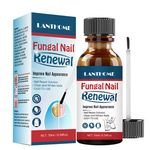 Lanthome New Herbal Anti Fungal Nail Treatment Liquid Fast Effect Clean and Whiten Nail Repair Essence