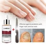 LANBENA 7 Days Nail Repair Serum Liquid Moisturizer Nail File Oil Gel for Hand and Foot Fungal Nail Treatment Damage Repair