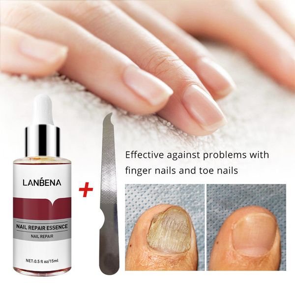 LANBENA 7 Days Nail Repair Serum Liquid Moisturizer Nail File Oil Gel for Hand and Foot Fungal Nail Treatment Damage Repair